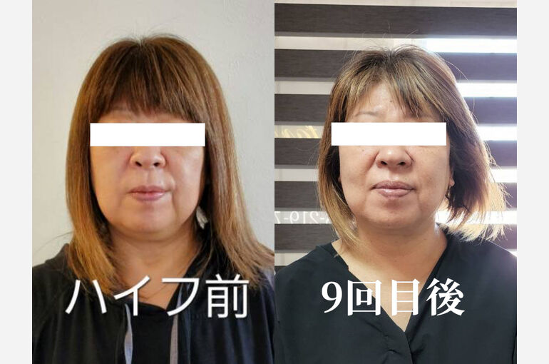 7F878CDD-CEAF-48D2-B443-2A144A693357